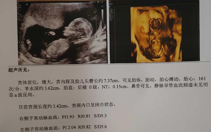 国内供卵试管代怀双胞胎【国内供卵试管代怀双胞胎:实现双胞胎梦想的最佳选择】