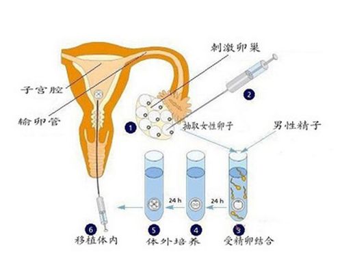 国内供卵试管婴儿合法吗(国内供卵试管婴儿合法吗?详解国内供卵试管婴儿法律规定)